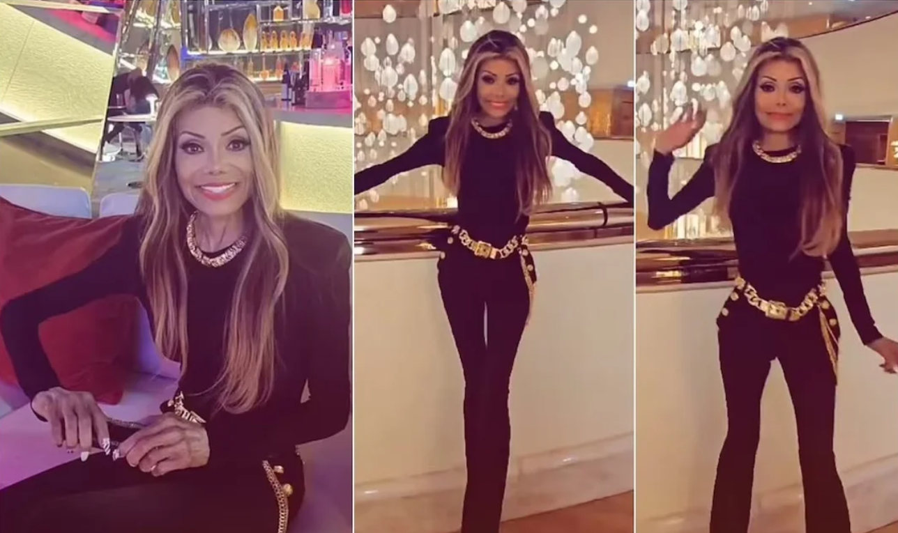 Preocupación por la extrema delgadez de la hermana de Michael Jackson: qué le pasa a La Toya | Espectaculos