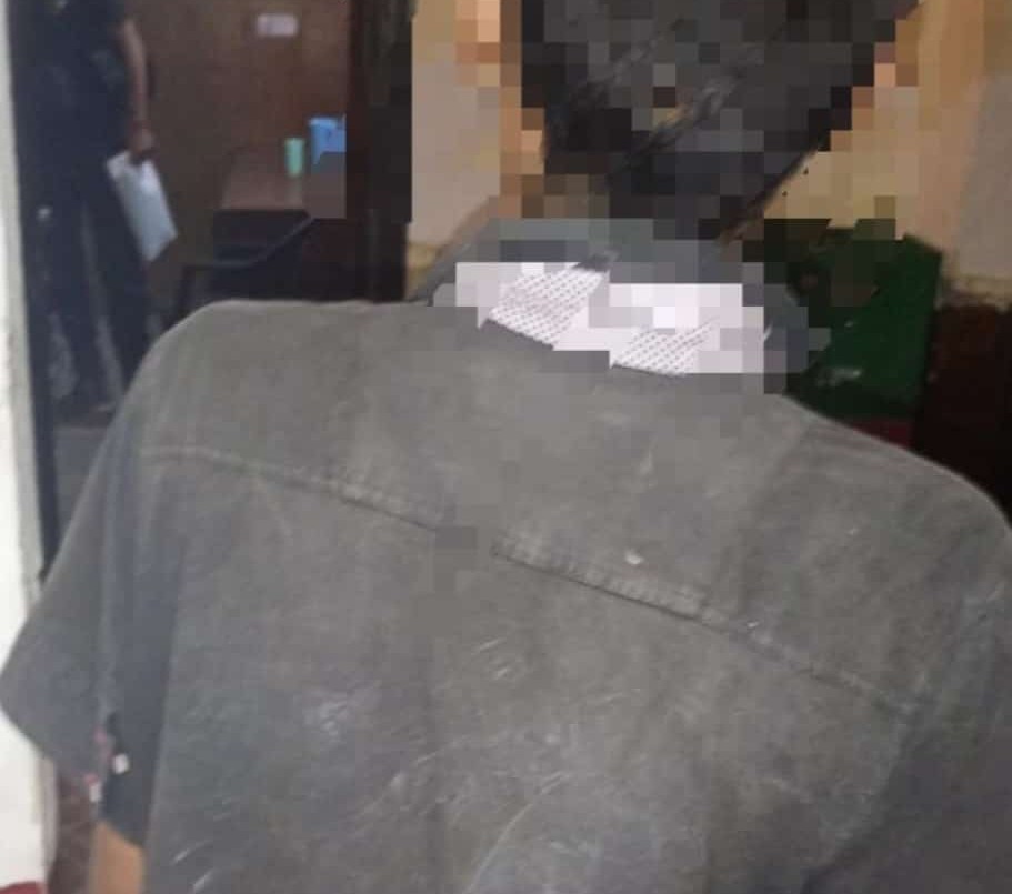 Mordió a un policía cuando intentaba huir tras cometer un robo | Policiales