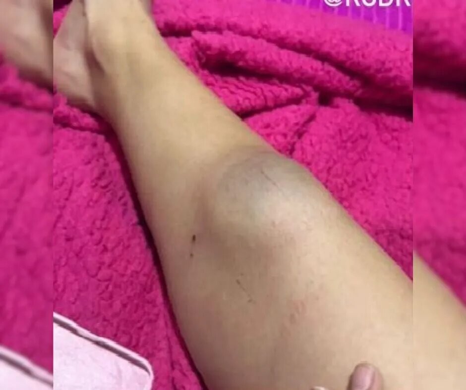 Un joven acusado de golpear a su pareja se entregó en una comisaría | Policiales