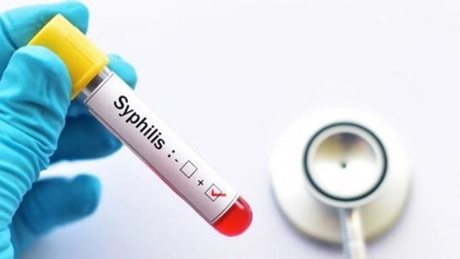 Preocupa el avance de la sífilis: se triplicaron los casos en adolescentes y recién nacidos | Salud
