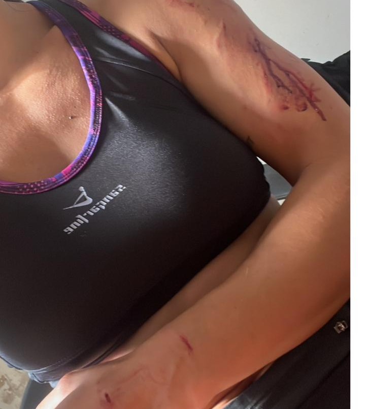 Otro caso más: una mujer fue atacada por un perro mientras corría | Policiales