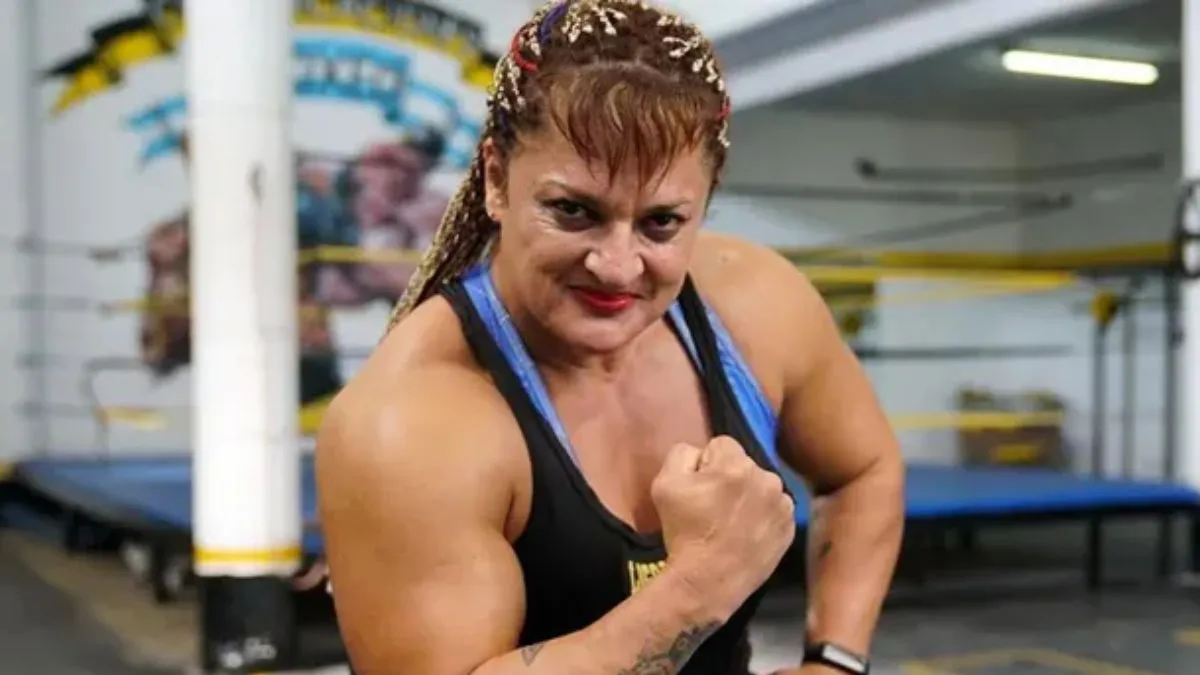 Locomotora Oliveras: Leves signos de mejorías tras realizarle una traqueotomía | Información General