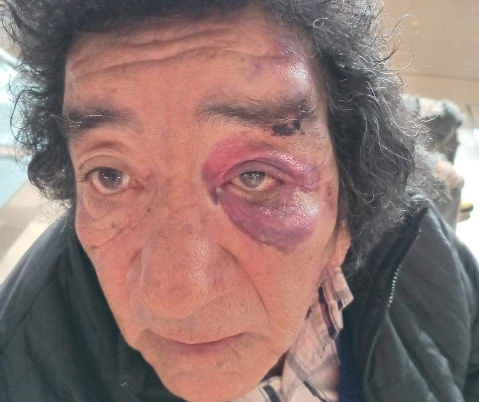 El músico Tito Frías fue atropellado y buscan al conductor que se dio a la fuga | Información General