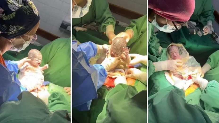 Un caso que sucede cada un millón: nacieron trigemelas en Salta | Nacionales