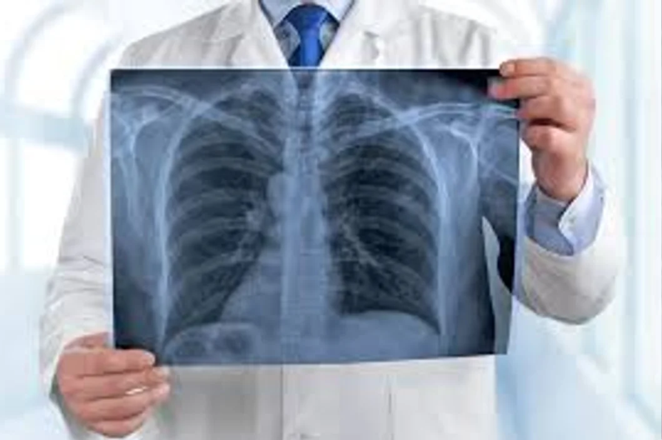 Día Mundial del Cáncer de Pulmón: alertan sobre el aumento de casos | Salud