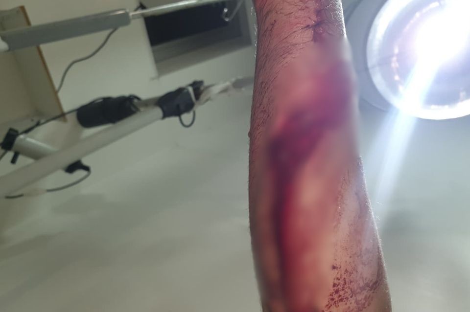 Un trabajador de la EPE fue atacado por perros y sufrió múltiples mordeduras | Información General