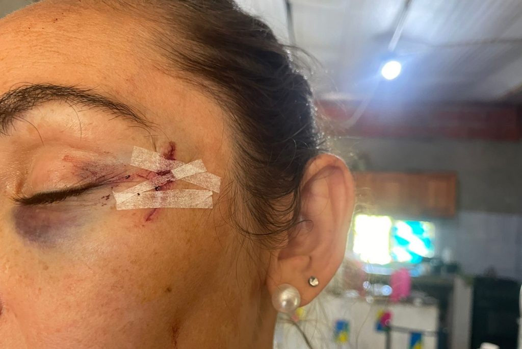 Fue agredida nuevamente la hermana del intendente de San José del Rincón | Policiales
