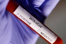 Tres nuevos casos de COVID-19 en la provincia: 2 en Fray Luis Beltrán y 1 en Rosario | Noticias