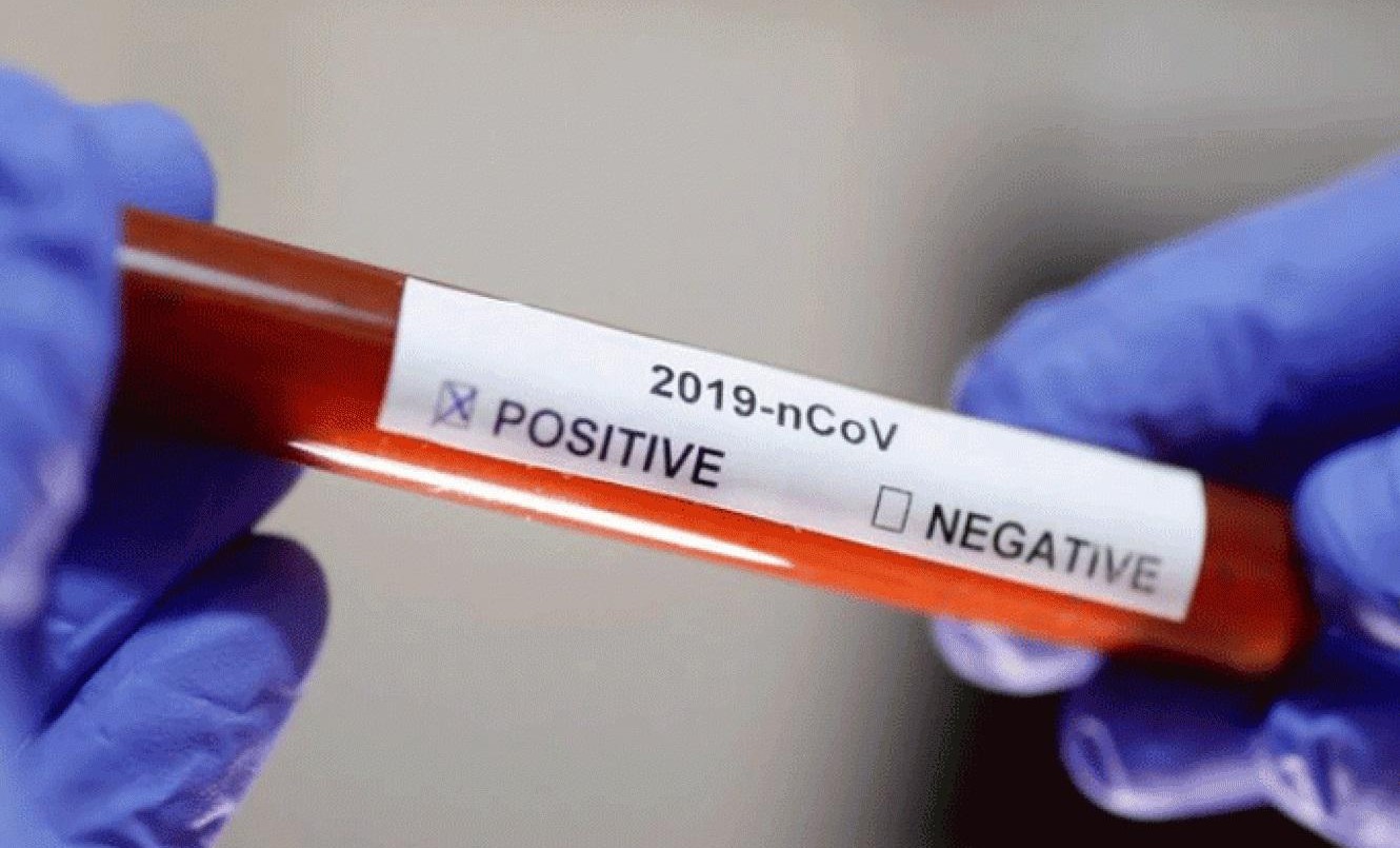 Dos nuevos casos de coronavirus en la provincia: son de Venado Tuerto y Las Rosas | Noticias