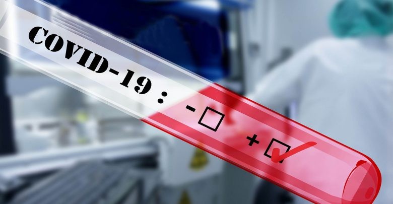 Se confirmaron 3 nuevos casos de coronavirus en la provincia: 1 en Ceres y 2 en Villa Ocampo | Noticias