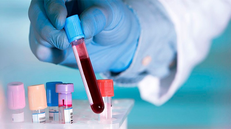 Se registraron 58 nuevos casos de coronavirus en Entre Ríos: 25 son de Paraná | Noticias