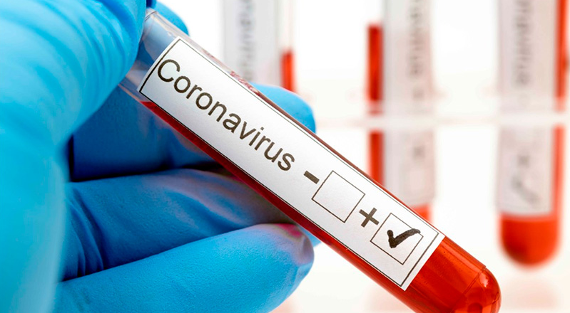 Se registraron 265 nuevos casos de coronavirus en Entre Ríos: 158 en Paraná | Noticias