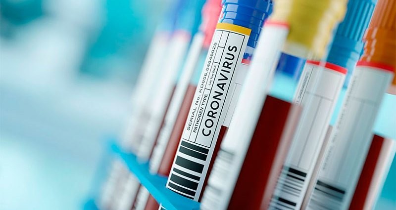 Reportaron 88 nuevos contagios en el departamento Paraná | Noticias