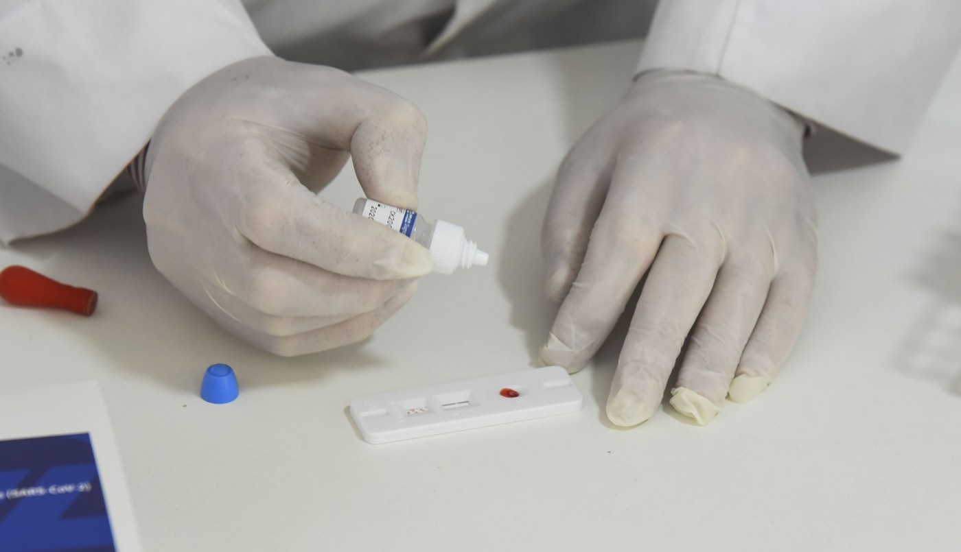 Covid-19: En los últimos tres meses se cuadruplicó la cantidad de testeos en territorio santafesino | Noticias