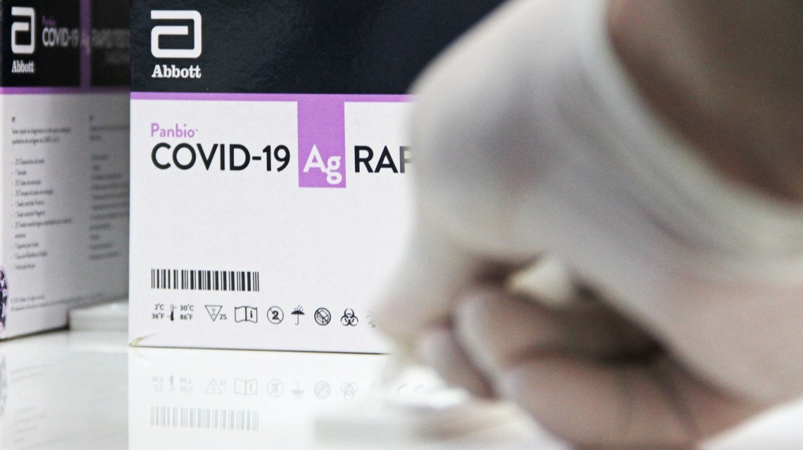 La provincia incorporó 110 mil test rápidos para la detección del virus | Noticias