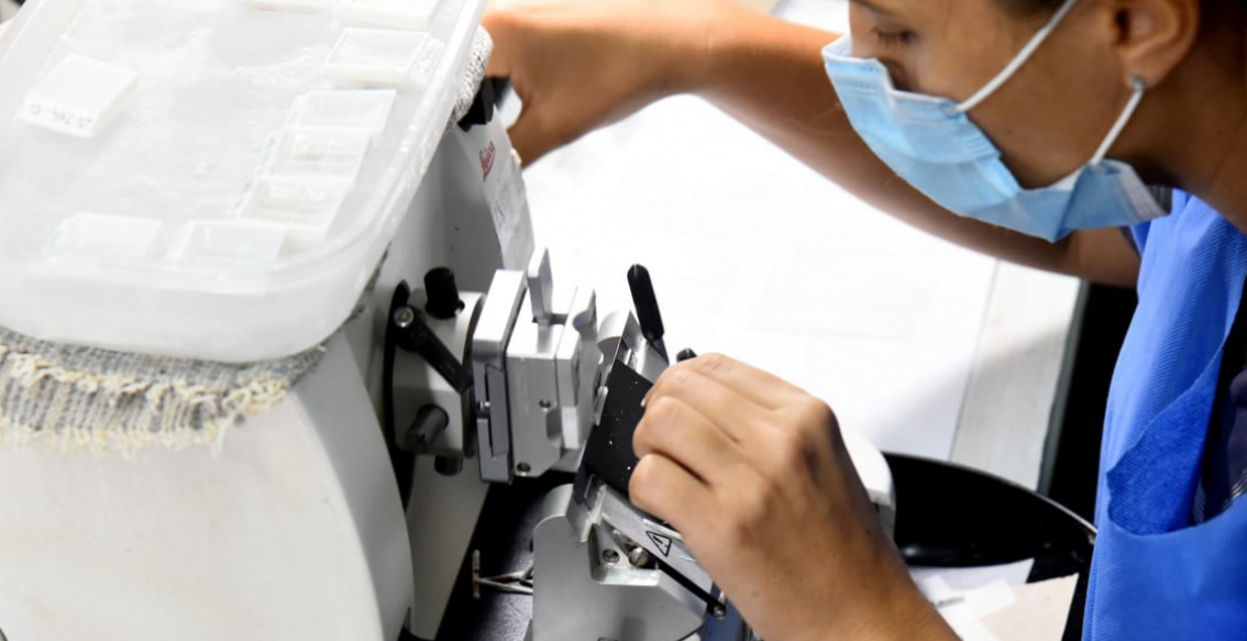 Salud realizará PAPs sin turno en la Semana de la Prevención del Cáncer de Cuello de Útero | Noticias