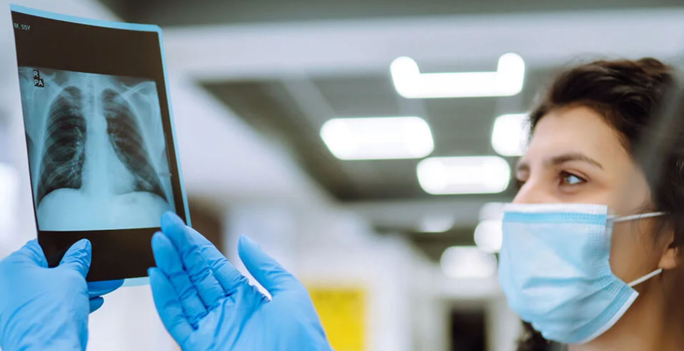 En Santa Fe se diagnostican entre 600 y 700 casos de tuberculosis por año | Información General