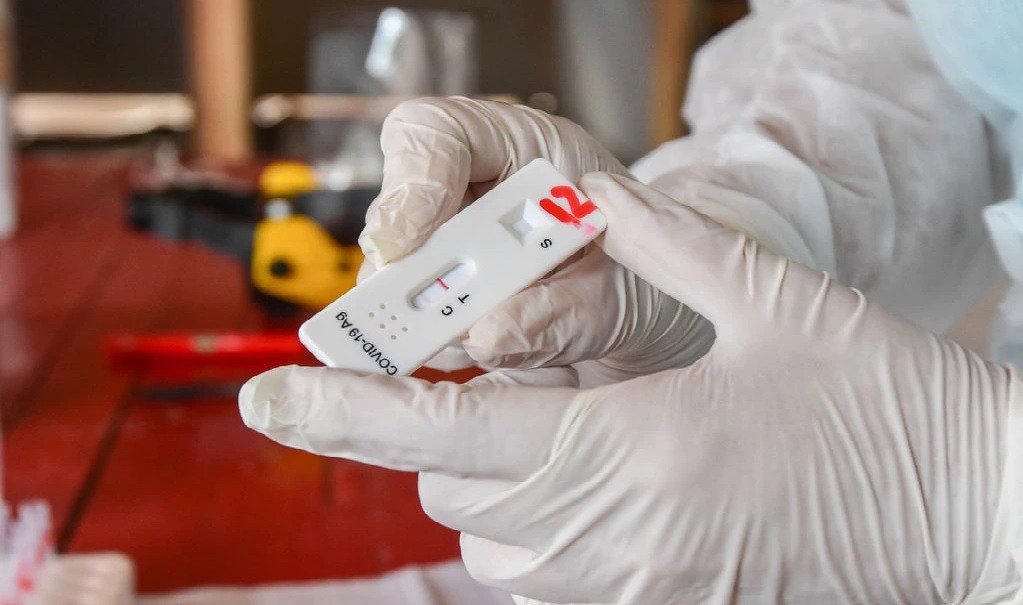 Reportaron 31.198 nuevos casos de Covid en Argentina, un 26% menos que la semana pasada | Información General