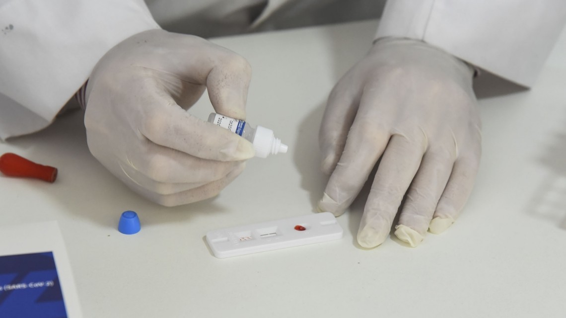 Hubo 2.935 contagios de coronavirus en el país | Información General