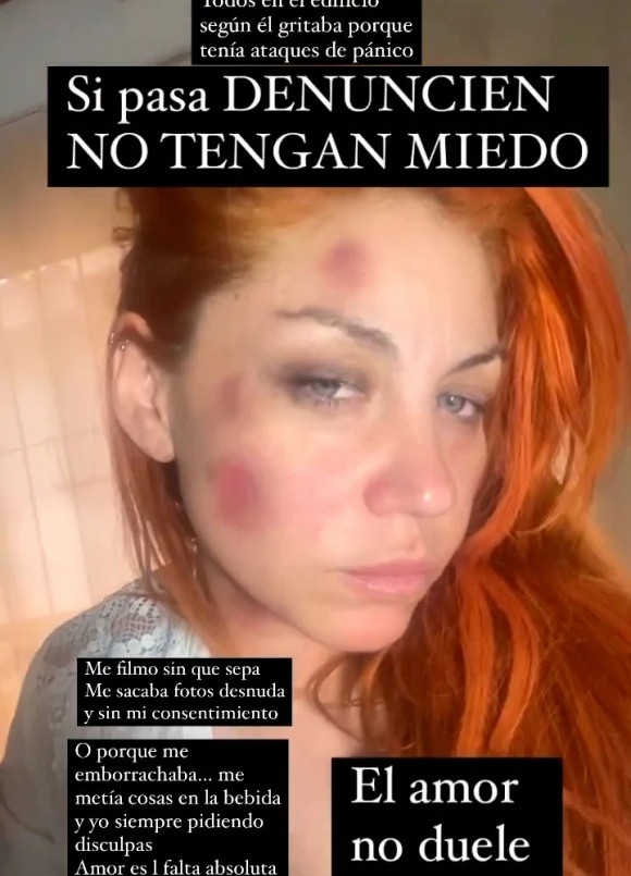 Lowrdez Fernández acusó a su novio de violencia de género | Nacionales