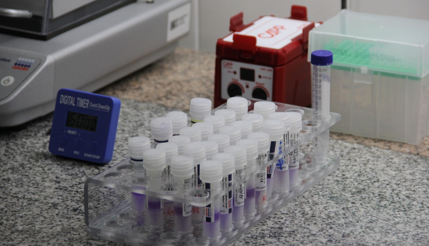 Impulsan la realización del test de VPH en mujeres mayores de 30 años | Información General