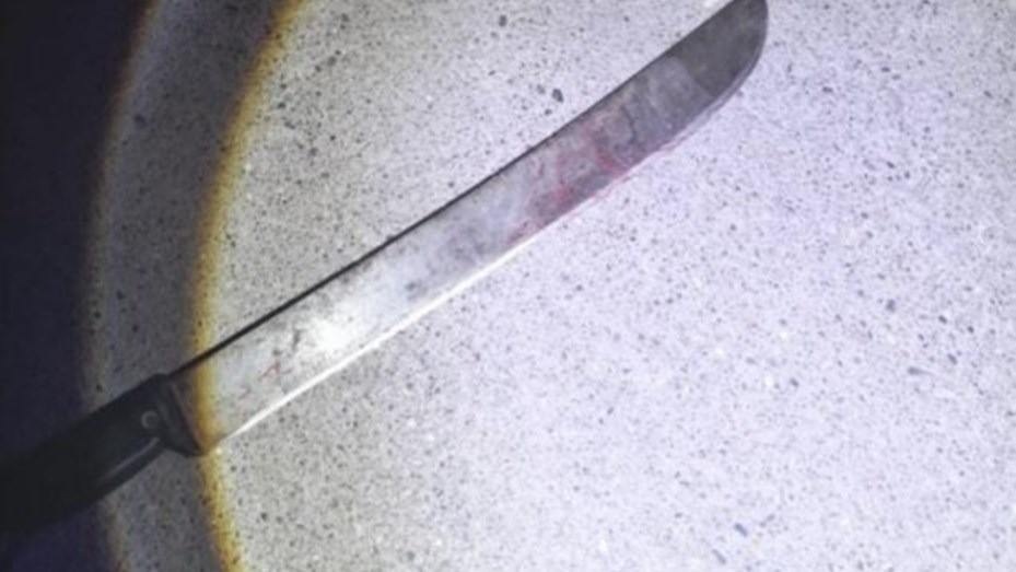 Encontró a un ladrón en el garaje de su casa y le amputó varios dedos a machetazos | Nacionales