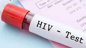 Hoy se conmemora el Día Internacional de la Acción Contra el Sida