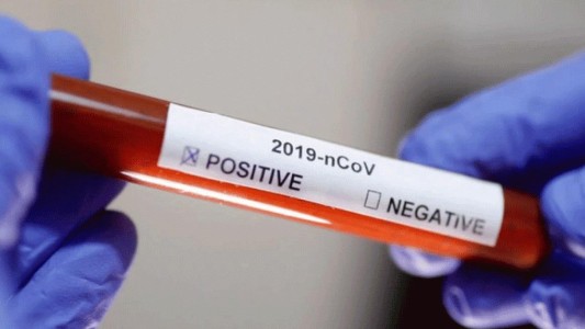 Dos nuevos casos de coronavirus en la provincia: son de Venado Tuerto y Las Rosas