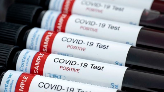 Paraná: confirman 10 casos de coronavirus en las últimas 24 horas