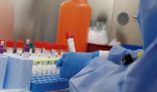 Récord: hubo 101 casos de covid en la provincia y 4 en la ciudad de Santa Fe