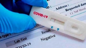 Se reportaron 542 casos de Covid - 19 en la provincia, 136 pertenecen a la ciudad