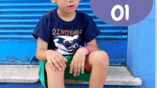 Se conmemora el Día Mundial del Síndrome de Moebius