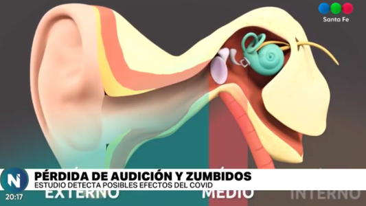 Pérdida de audición y zumbidos: posibles efectos del covid-19