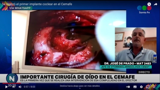 Se realizó el primer implante coclear en el Cemafe