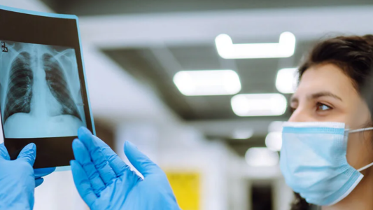 En Santa Fe se diagnostican entre 600 y 700 casos de tuberculosis por año