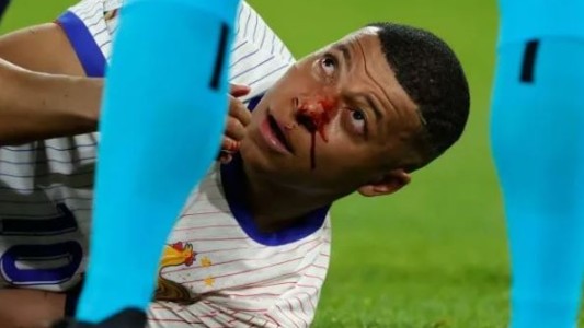 Mbappé se fracturó la nariz: será operado y podría perderse el resto de la Eurocopa