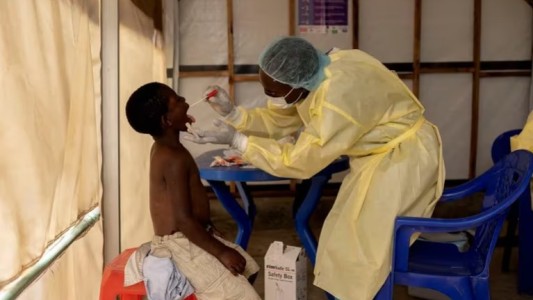 La OMS declaró la emergencia médica mundial por el brote de viruela del mono en África