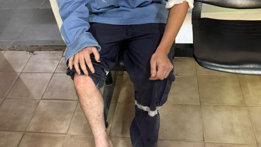 Un empleado de la EPE fue atacado por un grupo de perros