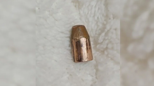 San José del Rincón: un adolescente de 13 años resultó herido al hacer explotar una bala de 9 mm con una pinza