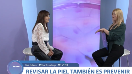 Somos Salud: Revisar la piel también es prevenir