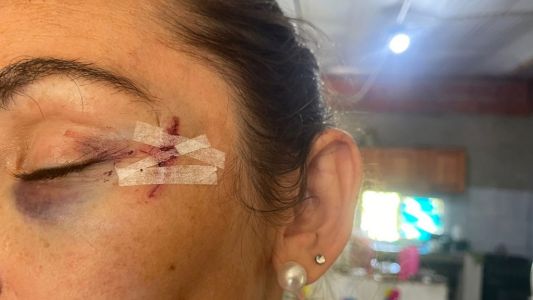 Fue agredida nuevamente la hermana del intendente de San José del Rincón