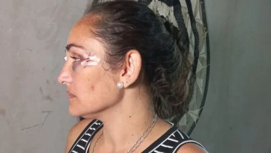 La hermana del intendente de Rincón lo denunció y señaló como autor intelectual de la golpiza que sufrió