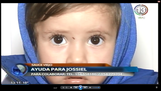 JOSSIEL, EL NIÑO CON LEUCOCEFALOPATÍA