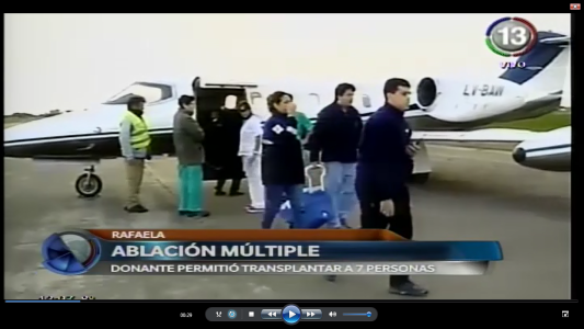 ABLACIÓN MÚLTIPLE EN RAFAELA