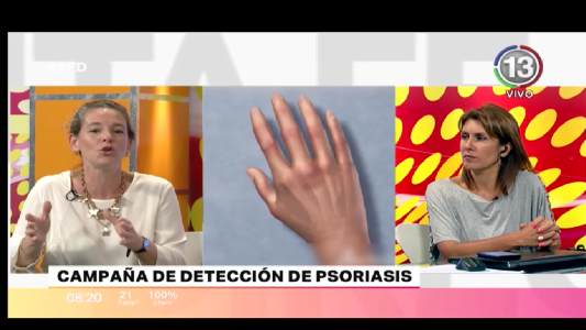 CAMPAÑA DE DETECCIÓN DE PSORIASIS Y ARTRITIS PSORIÁSICA
