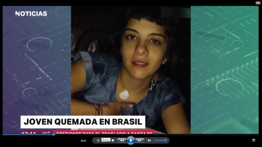 Joven quemada en Brasil