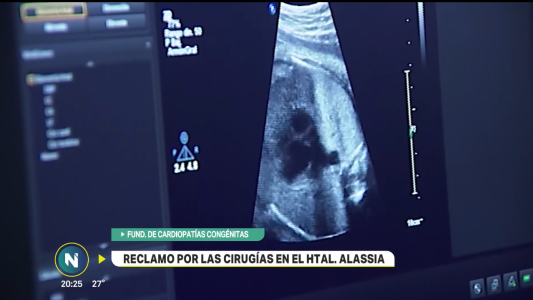 Cardiopatías Congénitas