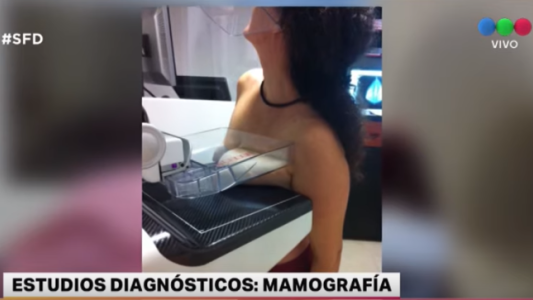 La salud de las mujeres: lo que hay que saber sobre mamografías