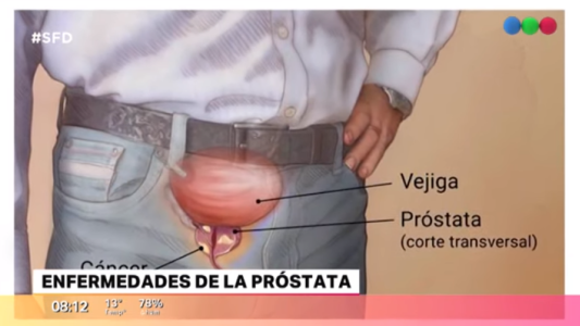 Cómo prevenir enfermedades en la próstata