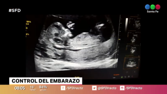 Paso a paso: los controles en el embarazo